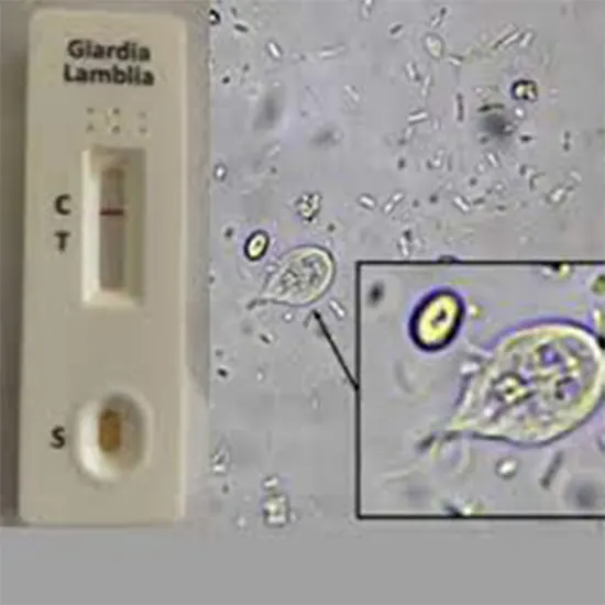 Giardia Antigen Detection